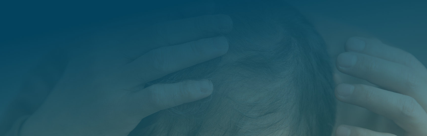 Causes of Hair Loss